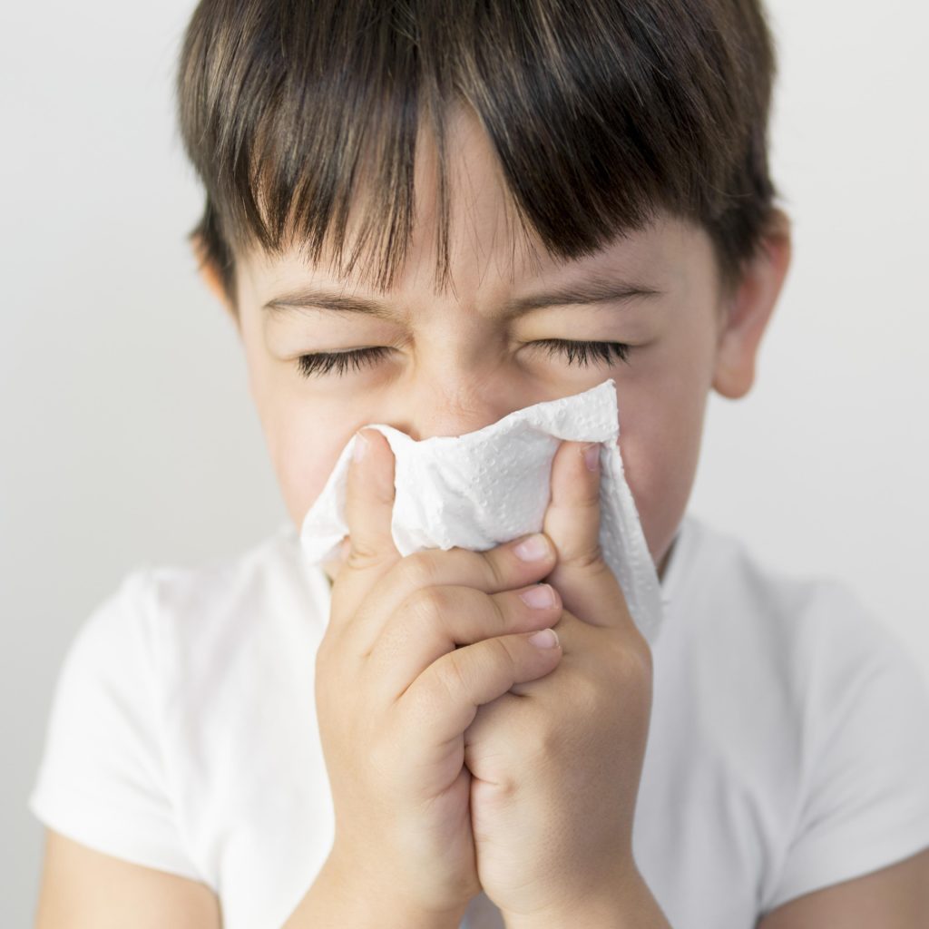 Croup: Viral infection in kids